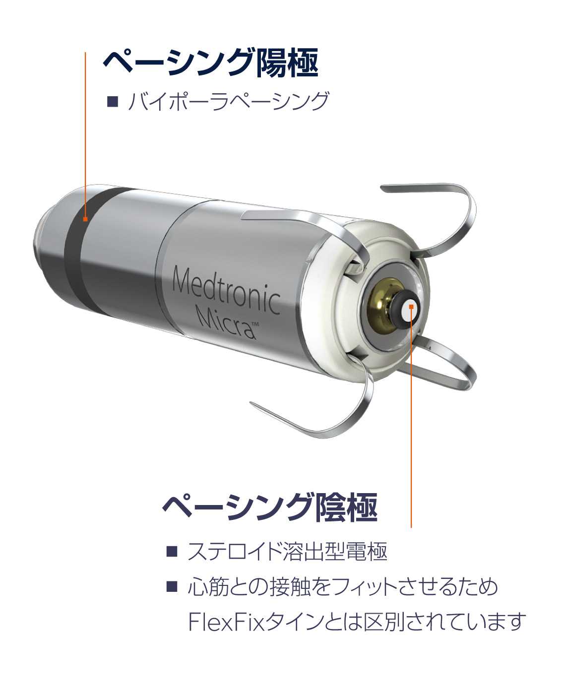 ペーシング陽極　ペーシング隠極